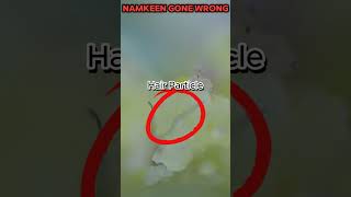 Namkeen Gone Wrong: Live Check Under the Microscope | Shocking Dust Particles Found!