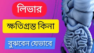 আপনার লিভার ক্ষতিগ্রস্ত কিনা বুঝবেন যেভাবে | liver problem | Health Story BD