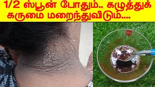 குளிக்கும் முன் கழுத்தில் தடவி குளிங்க | Remove Neck Blackness | black neck home remedies in tamil