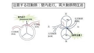 セッション2 複雑性先天性心疾患をじっくり学ぼう