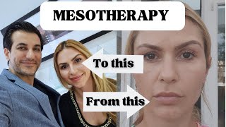 I Have Tried Mesotherapy| Dr Deniz Kanliada #mesotherapy