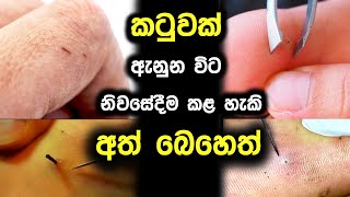 කටුවක් ඇනුන විට නිවසේදීම කළහැකි ප්‍රතිකාර |Medicine at Home|Ayurveda Medicine sri lanka 2021 Sinhala