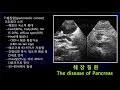 소노엠 메디컬 아카데미 췌장암 초음파 image finding