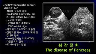 [소노엠 메디컬 아카데미]  췌장암 초음파 image Finding