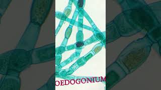 BSC BOTANY PRACTICAL -OEDOGONIUM #algae #biology #college degree