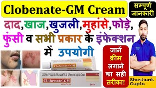 Clobenate-GM Cream की सम्पूर्ण जानकारी |दाद,खाज,खुजली, मुहांसे व सभी प्रकार के इंफेक्शन में उपयोगी🔥💊