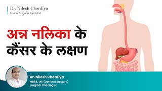 अन्न नलिका के कैंसर के लक्षण | Esophageal cancer symptoms | Food pipe cancer (Hindi) | Dr  Nilesh