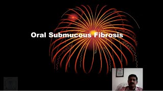 Oral Submucous Fibrosis