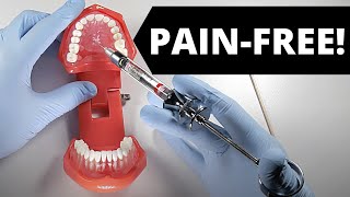 Deliver A Painless Palatal Injection | OnlineExodontia.com