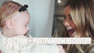 My Quick C-Section Recovery + Postpartum Depression Update | Vlog Ep.16 | ellebangs