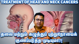 Treatment of head and neck cancers| தலை மற்றும் கழுத்துப் புற்றுநோயைக் குணப்படுத்த முடியுமா?!