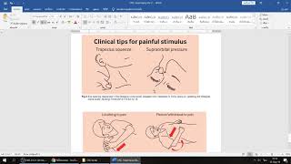 Guideline HEAD INJURY สำหรับ รพ  สต  ตอนที่ 4/4 - การประเมิน GLASGOW COMA SCORE