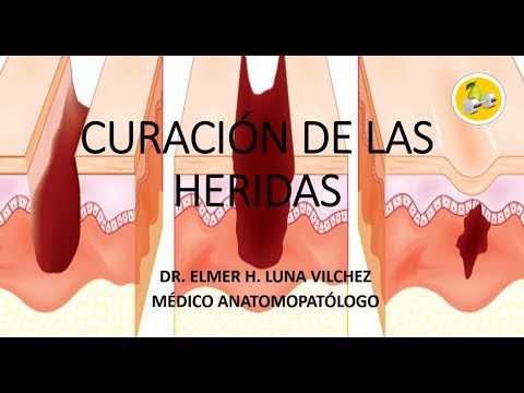 CURACIÓN DE LAS HERIDAS -Dr. Elmer H. Luna Vilchez - YouTube