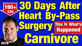 30 Days out of open heart By-Pass surgery. #carnivorehealing #keto #weightlossjourney #heartsurgery