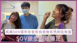 【SOV舒服美】孔凡娜 - 我戴SOV隱形牙套所有食物依然照吃無誤！｜數位隱形矯正｜隱形牙套｜無痛矯正