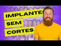 Descubra: Implantes sem cortes são uma realidade? Saiba se são adequados para o seu caso!