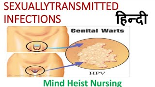 Genital Warts STD/STI, Midwifery and obstetrics Explained In Hindi