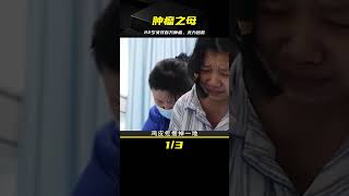 22歲女孩稱為“腫瘤之母”，全身超過1000個腫瘤，醫生有錢治不了 #鉴证史者 #古董 #開棺 #古墓 #考古發現