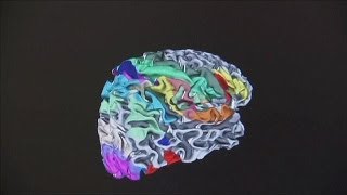 Faire la carte du cerveau - science