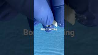 GTO bone graft short