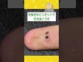 【2ch面白いスレ】俺の指と同じ状態の奴いたら教えろwwww 2ch 2chスレ 面白い shorts