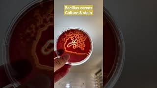 ➡️ Bacillus cereus cultivation and gram stain   #تحاليل_طبية #microbiology #TAG_Academy