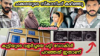 ചക്കരയുടെ സ്കാനിംഗ് കഴിഞ്ഞു🤰കുട്ടിയുടെ വളർച്ചയെ പറ്റി ഡോക്ടർ പറഞ്ഞത് ഇതാണ്🥹PREGNANCY|LOVE|FAMILY