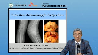 대한슬관절학회 - TKA for valgus knee  - 최충혁 교수 (한양의대)