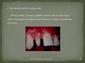 etiology of malocclusion local factors