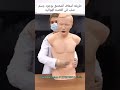 طريقه اسعاف المختنق