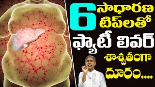 Fatty Liver |ఫ్యాటీ లివర్ కేవలం ఈ 6 టిప్ లతో దూరం | Dr Manthena Satyanarayana Raju | HEALTH MANTRA