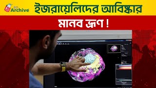 ই'জরায়েলিদের আবিষ্কার মানব ভ্রূণ! | News | Israel | Human Fetus | Innovation | International