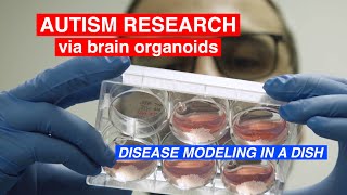 Stem Cells and Disease Modeling in a Dish, Autism Research via Brain Organoids