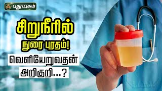 சிறுநீரில் நுரை புரதம்! வெளியேறுவதன் அறிகுறி...?  Dr. Rajalakshmi  | Doctor On Call | 08/08/2023