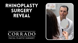 Rhinoplasty Reveal One Week After Surgery | Dr. Corrado