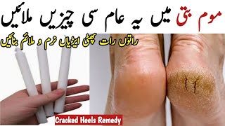 Repair Cracked Heels In 1Day | Get Rid Of Crack Heels | Cracked Heel Cream | Phati Aeriyo ka ilaj