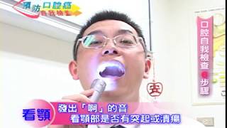 預防口腔癌 自我檢查