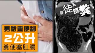 【便祕動畫】男嚴重便秘2公升糞便塞肛腸　醫徒手挖糞 | 台灣蘋果日報