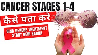 Cancer stages 1-4 in Hindi | Cancer stages explained