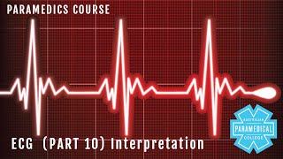 ECG Part 10 Interpreting an ECG - Australian Paramedical College