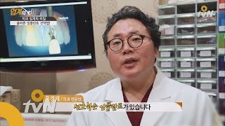 topsecret 60여종의 임플란트! 현직 의사가 말하는 올바른 선택법! 151111 EP.3