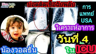 วันที่ 4 ในห้อง ICU จากอาการปอดติดเชื้อฉับพลัน/การรักษาของแพทย์ USA หลังจากอาการแย่ลงวันก่อน