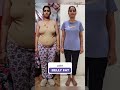 17 kgs weight loss and belly fatloss post delivery