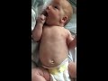 what does rsv look and sound like in babies and kids