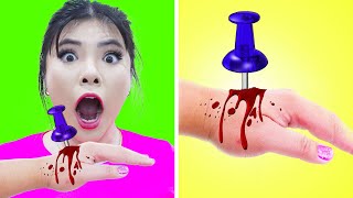7 CRAZY REMEDIES & LIFE HACKS TO SURVIVE | EMERGENCY TIPS, TRICKS & FUNNY SITUATION BY CRAFTY HACKS