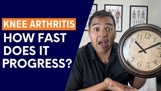 How Long Does It Actually Take Knee Arthritis To Progress?