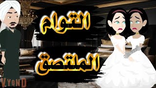 توام ملتصق كامله