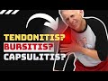 Shoulder Pain? Is it Tendonitis, Bursitis, or Capsulitis?