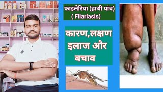 फाइलेरिया ( हाथी पांव) elephantiasis कारण,लक्षण, इलाज और बचाव ‌