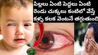 How to Reduce Conjunctivitis | Monsoon Virus | Precautions and Remedies | కళ్ళ కలక తక్షణమే తగ్గాలంటే